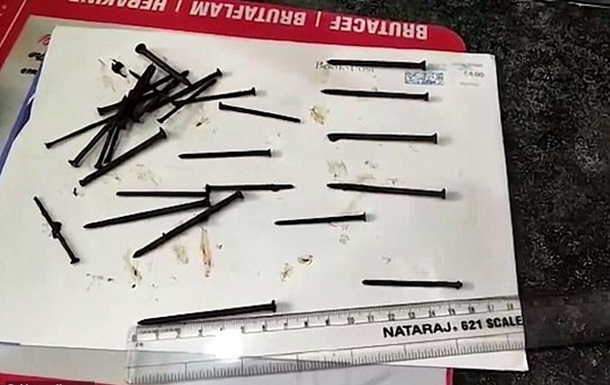 Индус случайно проглотил 116 гвоздей и провод