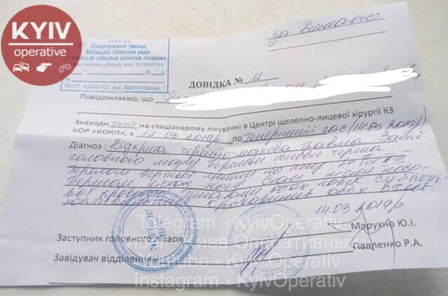 Сломаны нос и челюсть: в Киеве маршрутчик зверски избил пассажира