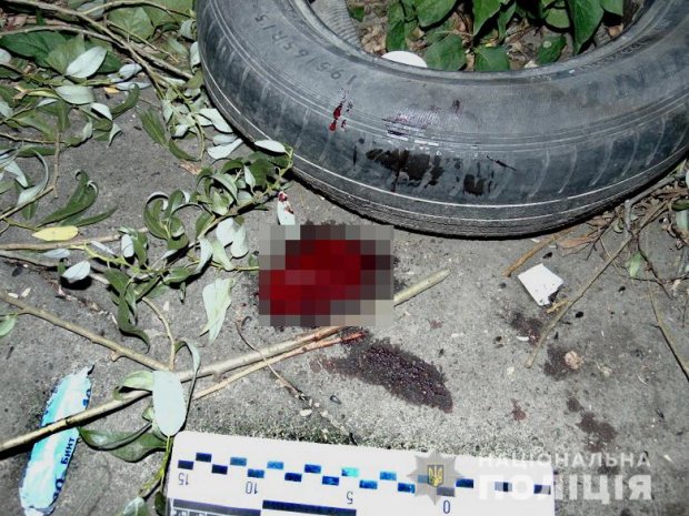 В Києві чоловік вдарив дівчину ножем у шию: деталі події