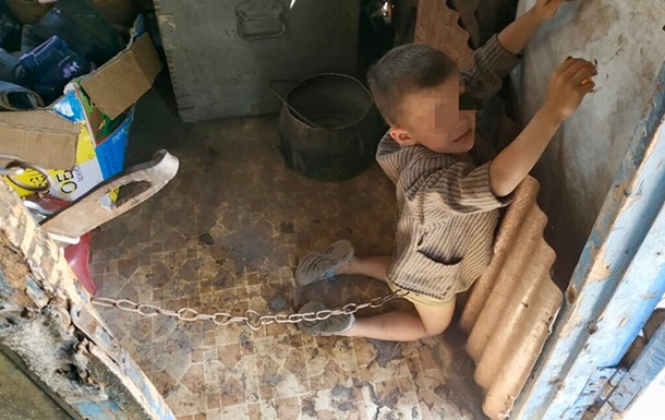 В Луганской области родители держали на цепи маленького ребенка