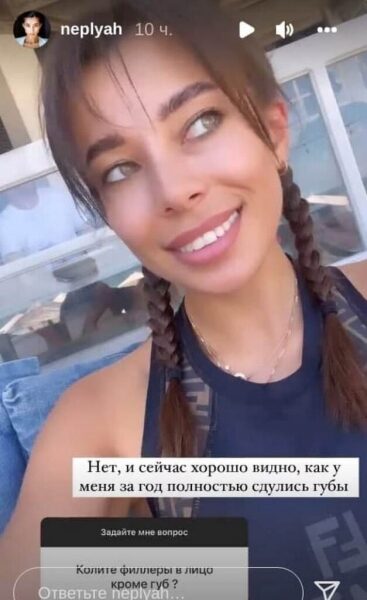 Никакой пластики: Анна Неплях показала, как выглядела в 17 лет Никакой пластики: Анна Неплях показала, как выглядела в 17 лет
