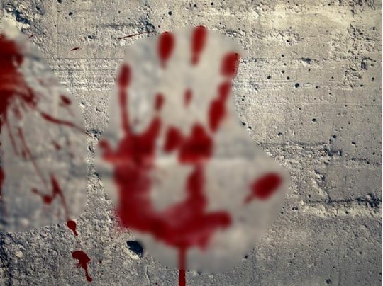 Відрізали в&nbsp;живої людини: Макрону поштою надіслали&hellip; палець