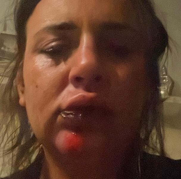 Футболіст жорстоко побив свою дівчину: щоб урятуватися, та&nbsp;вистрибнула з&nbsp;балкона (фото, відео)
